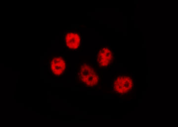 LIMK1 / LIMK Antibody - Staining NIH-3T3 cells by IF/ICC. The samples were fixed with PFA and permeabilized in 0.1% Triton X-100, then blocked in 10% serum for 45 min at 25°C. The primary antibody was diluted at 1:200 and incubated with the sample for 1 hour at 37°C. An Alexa Fluor 594 conjugated goat anti-rabbit IgG (H+L) Ab, diluted at 1/600, was used as the secondary antibody.