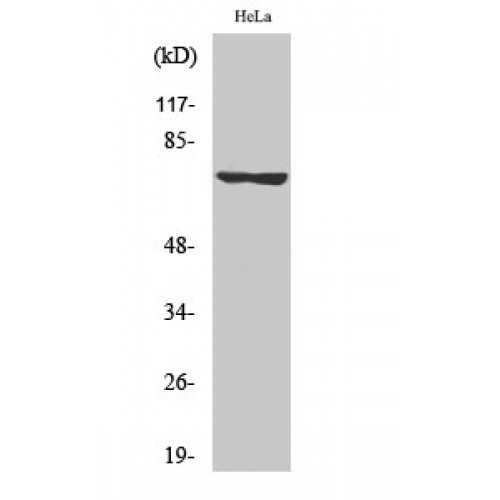 LIMK1 + LIMK2 Antibody - Western blot of Phospho-LIMK-1/2 (T508/505) antibody