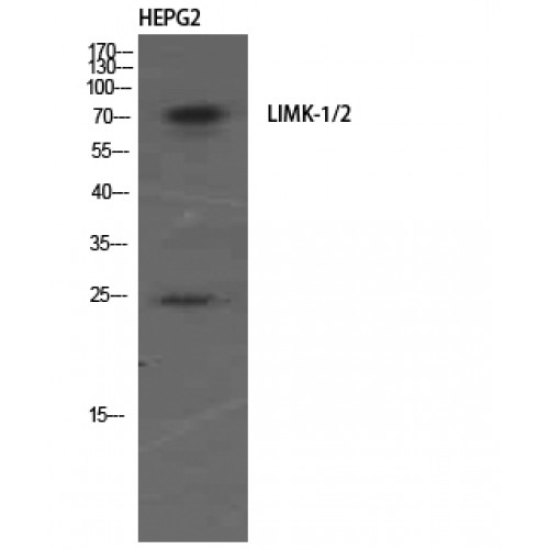 LIMK1 + LIMK2 Antibody - Western blot of LIMK-1/2 antibody