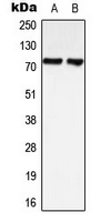 LIMK1 + LIMK2 Antibody - Western blot analysis of LIMK1/2 expression in HeLa (A); SHSY5Y (B) whole cell lysates.