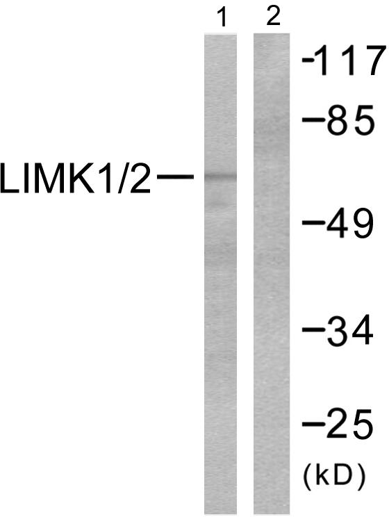 LIMK1 + LIMK2 Antibody - Western blot analysis of extracts from cos7 cells, using LIMK1/2 (Ab-508/505) antibody ( Line 1 and 2).