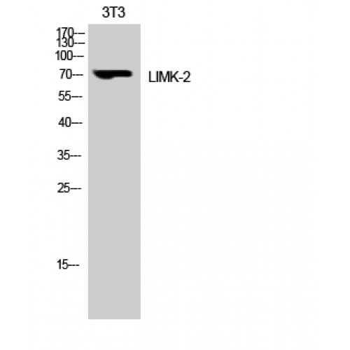LIMK2 Antibody - Western blot of LIMK-2 antibody