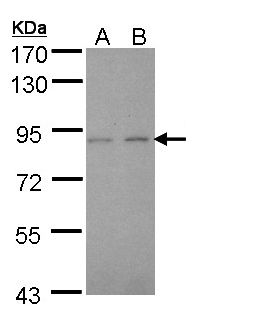 LIMK2 Antibody - Sample (30 ug of whole cell lysate). A: A431 , B: H1299. 7.5% SDS PAGE. LIMK2 antibody diluted at 1:2000