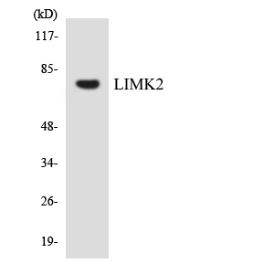 LIMK2 Antibody - Western blot analysis of the lysates from RAW264.7cells using LIMK2 antibody.