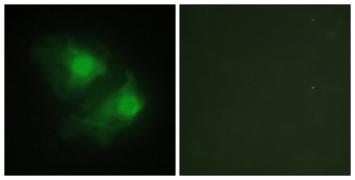 LIMK2 Antibody - Immunofluorescence analysis of HeLa cells, using LIMK2 Antibody. The picture on the right is blocked with the synthesized peptide.