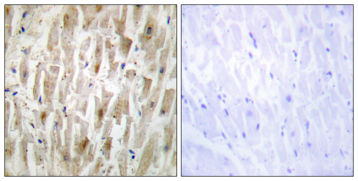 LIMK2 Antibody - Immunohistochemistry analysis of paraffin-embedded human heart tissue, using LIMK2 Antibody. The picture on the right is blocked with the synthesized peptide.