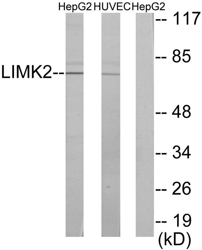 LIMK2 Antibody - Western blot analysis of lysates from HepG2 and HUVEC cells, using LIMK2 Antibody. The lane on the right is blocked with the synthesized peptide.