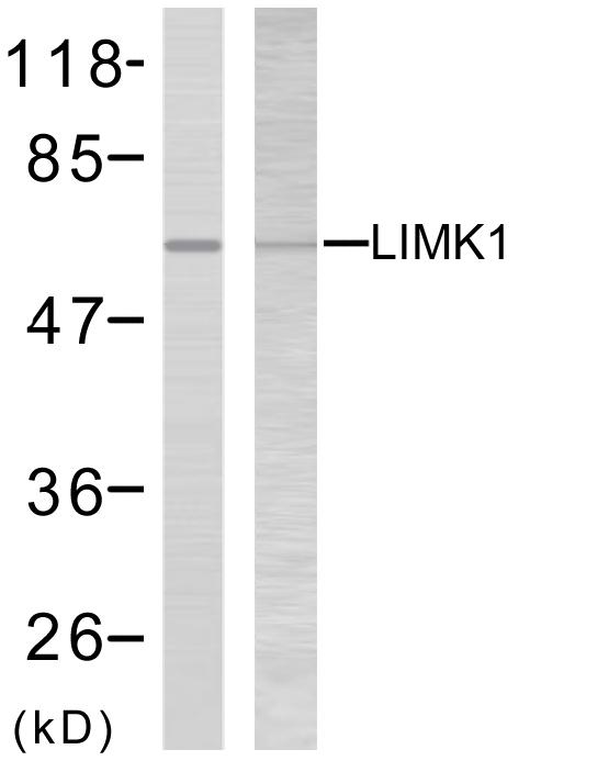 LIMK2 Antibody - Western blot analysis of lysates from NIH/3T3 cells, treated with UV, using LIMK2 Antibody. The lane on the right is blocked with the synthesized peptide.