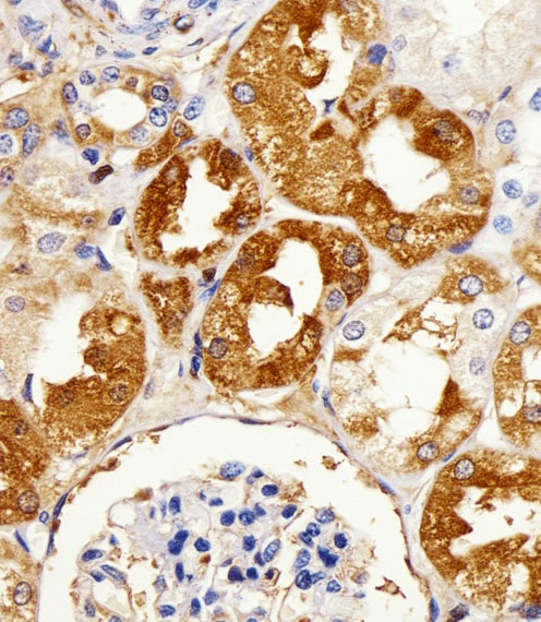 LIMK2 Antibody - Immunohistochemical of paraffin-embedded H.kidney section using LIMK2 Antibody. Antibody was diluted at 1:25 dilution. A peroxidase-conjugated goat anti-rabbit IgG at 1:400 dilution was used as the secondary antibody, followed by DAB staining.