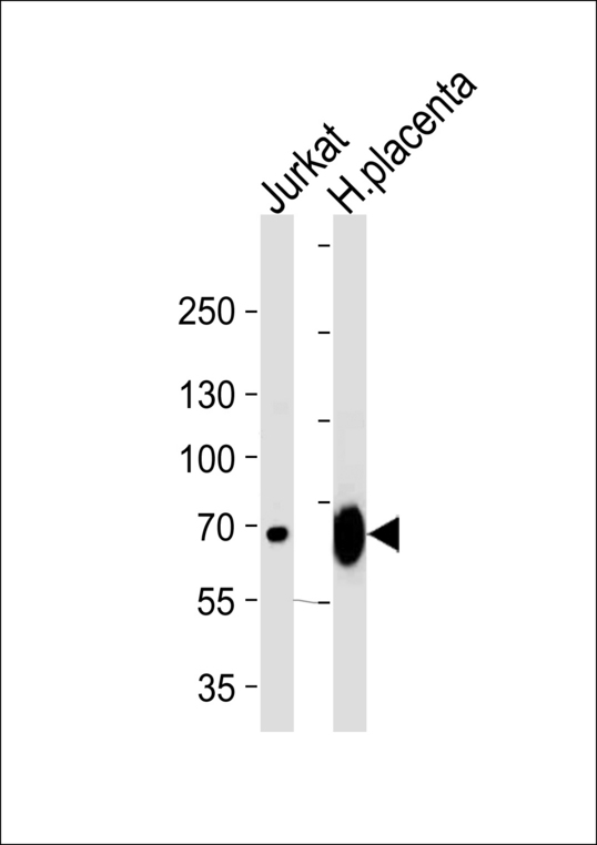 LIMK2 Antibody - Western blot of lysates from Jurkat cell line and human placenta tissue lysate (from left to right), using LIMK2 Antibody. Antibody was diluted at 1:1000 at each lane. A goat anti-rabbit IgG H&L (HRP) at 1:5000 dilution was used as the secondary antibody. Lysate at 35ug per lane.