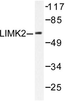 LIMK2 Antibody - Western blot of LIMK2 (D499) pAb in extracts from NIH/3T3 treated with UV.
