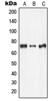 LIMK2 Antibody - Western blot analysis of LIMK2 expression in Jurkat (A); COLO205 (B); MCF7 (C) whole cell lysates.