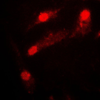 LIMK2 Antibody - Immunofluorescent analysis of LIMK2 staining in COLO205 cells. Formalin-fixed cells were permeabilized with 0.1% Triton X-100 in TBS for 5-10 minutes and blocked with 3% BSA-PBS for 30 minutes at room temperature. Cells were probed with the primary antibody in 3% BSA-PBS and incubated overnight at 4 C in a humidified chamber. Cells were washed with PBST and incubated with a DyLight 594-conjugated secondary antibody (red) in PBS at room temperature in the dark. DAPI was used to stain the cell nuclei (blue).