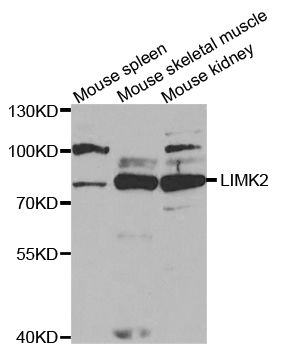 LIMK2 Antibody - Western blot analysis of extracts of various cell lines.