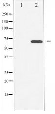 LIMK2 Antibody - Western blot of LIMK2 expression in PMA treated NIH-3T3 whole cell lysates,The lane on the left is treated with the antigen-specific peptide.