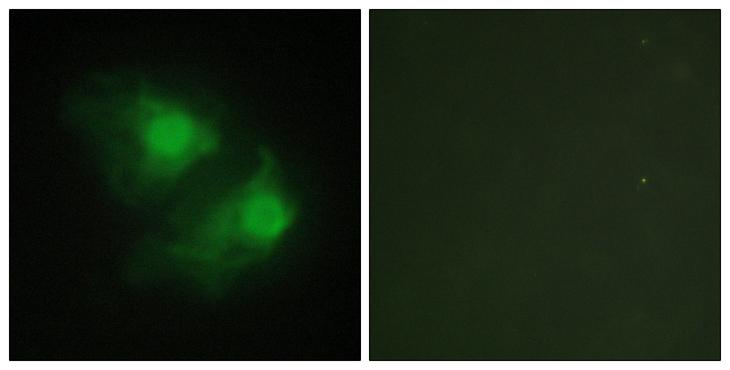 LIMK2 Antibody - Peptide - + Immunofluorescence analysis of HeLa cells, using LIMK2 antibody.