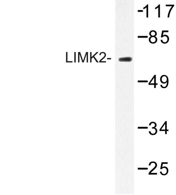 LIMK2 Antibody - Western blot of LIMK2 (K491) pAb in extracts from HepG2 cells.