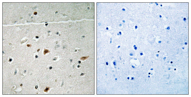 LIMK2 Antibody - Immunohistochemistry analysis of paraffin-embedded human brain, using LIMK2 (Phospho-Ser283) Antibody. The picture on the right is blocked with the phospho peptide.