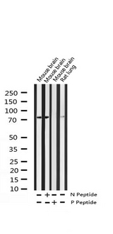 LIMK2 Antibody - Western blot analysis of Phospho-LIMK2 (Ser283) expression in various lysates