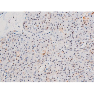 LIMK2 Antibody - 1:200 staining human pancreas tissue by IHC-P. The tissue was formaldehyde fixed and a heat mediated antigen retrieval step in citrate buffer was performed. The tissue was then blocked and incubated with the antibody for 1.5 hours at 22°C. An HRP conjugated goat anti-rabbit antibody was used as the secondary.