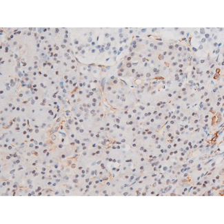 LIMK2 Antibody - 1:200 staining human pancreas tissue by IHC-P. The tissue was formaldehyde fixed and a heat mediated antigen retrieval step in citrate buffer was performed. The tissue was then blocked and incubated with the antibody for 1.5 hours at 22°C. An HRP conjugated goat anti-rabbit antibody was used as the secondary.