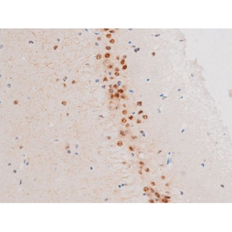 LIMK2 Antibody - 1:200 staining mouse brain1.JPG tissue by IHC-P. The tissue was formaldehyde fixed and a heat mediated antigen retrieval step in citrate buffer was performed. The tissue was then blocked and incubated with the antibody for 1.5 hours at 22°C. An HRP conjugated goat anti-rabbit antibody was used as the secondary.