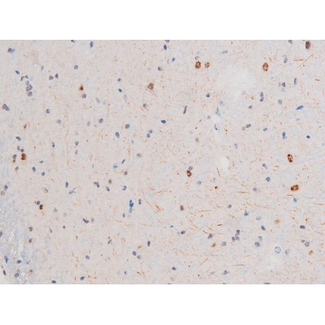 LIMK2 Antibody - 1:200 staining mouse brain2.JPG tissue by IHC-P. The tissue was formaldehyde fixed and a heat mediated antigen retrieval step in citrate buffer was performed. The tissue was then blocked and incubated with the antibody for 1.5 hours at 22°C. An HRP conjugated goat anti-rabbit antibody was used as the secondary.