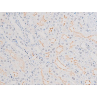 LIMK2 Antibody - 1:200 staining rat kidney tissue by IHC-P. The tissue was formaldehyde fixed and a heat mediated antigen retrieval step in citrate buffer was performed. The tissue was then blocked and incubated with the antibody for 1.5 hours at 22°C. An HRP conjugated goat anti-rabbit antibody was used as the secondary.