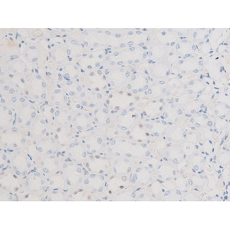 LIMK2 Antibody - 1:200 staining rat kidney tissue by IHC-P. The tissue was formaldehyde fixed and a heat mediated antigen retrieval step in citrate buffer was performed. The tissue was then blocked and incubated with the antibody for 1.5 hours at 22°C. An HRP conjugated goat anti-rabbit antibody was used as the secondary.