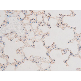 LIMK2 Antibody - 1:200 staining rat lung tissue by IHC-P. The tissue was formaldehyde fixed and a heat mediated antigen retrieval step in citrate buffer was performed. The tissue was then blocked and incubated with the antibody for 1.5 hours at 22°C. An HRP conjugated goat anti-rabbit antibody was used as the secondary.