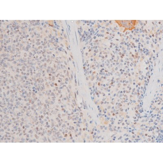 LIMK2 Antibody - 1:200 staining rat spleen tissue by IHC-P. The tissue was formaldehyde fixed and a heat mediated antigen retrieval step in citrate buffer was performed. The tissue was then blocked and incubated with the antibody for 1.5 hours at 22°C. An HRP conjugated goat anti-rabbit antibody was used as the secondary.