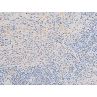 LIMK2 Antibody - 1:200 staining rat spleen tissue by IHC-P. The tissue was formaldehyde fixed and a heat mediated antigen retrieval step in citrate buffer was performed. The tissue was then blocked and incubated with the antibody for 1.5 hours at 22°C. An HRP conjugated goat anti-rabbit antibody was used as the secondary.