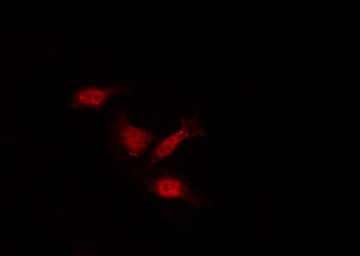 LIMK2 Antibody - Staining NIH-3T3 cells by IF/ICC. The samples were fixed with PFA and permeabilized in 0.1% Triton X-100, then blocked in 10% serum for 45 min at 25°C. The primary antibody was diluted at 1:200 and incubated with the sample for 1 hour at 37°C. An Alexa Fluor 594 conjugated goat anti-rabbit IgG (H+L) Ab, diluted at 1/600, was used as the secondary antibody.