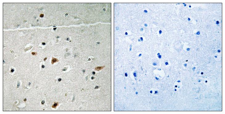 LIMK2 Antibody - P-peptide - + Immunohistochemistry analysis of paraffin-embedded human brain tissue using LIMK2 (Phospho-Ser283) antibody.