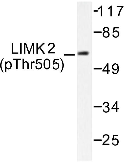 LIMK2 Antibody - Western blot of p-LIMK2 (T505) pAb in extracts from COLO cells.
