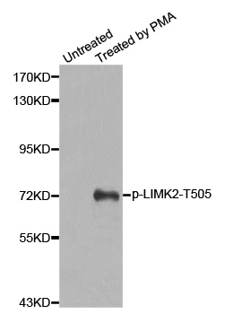 LIMK2 Antibody - Western blot analysis of extracts from Hela cells.