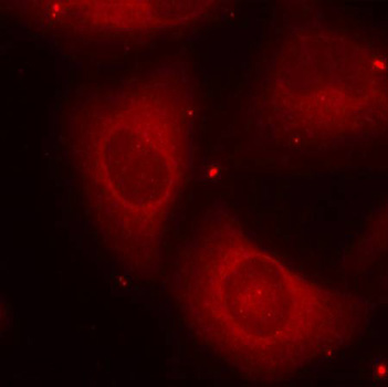 LIMK2 Antibody - Immunofluorescence staining of methanol-fixed Hela cells.