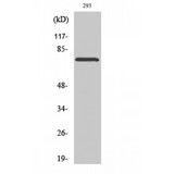 LIMK2 Antibody - Western blot of Phospho-LIMK-2 (T505) antibody