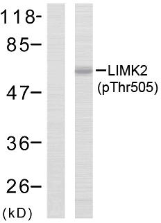 LIMK2 Antibody - Western blot analysis of the extracts from MCF7 cells using LIMK2 (phospho-Thr505) antibody.