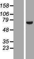 LIMK2 Protein - Western validation with an anti-DDK antibody * L: Control HEK293 lysate R: Over-expression lysate