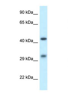 LIMPII / SCARB2 Antibody - SCARB2 / SR-BII antibody Western blot of 1 Cell lysate. Antibody concentration 1 ug/ml. This image was taken for the unconjugated form of this product. Other forms have not been tested.