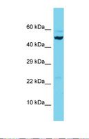LIMPII / SCARB2 Antibody - Western blot of Human 721_B. SCARB2 antibody dilution 1.0 ug/ml.  This image was taken for the unconjugated form of this product. Other forms have not been tested.