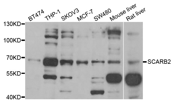 LIMPII / SCARB2 Antibody - Western blot analysis of extracts of various cell lines.