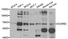 LIMPII / SCARB2 Antibody - Western blot analysis of extracts of various cell lines.
