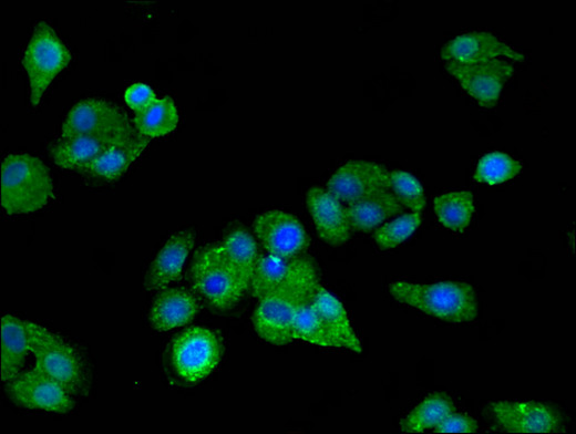 LIMPII / SCARB2 Antibody - Immunofluorescent analysis of HepG2 cells using SCARB2 Antibody at a dilution of 1:100 and Alexa Fluor 488-congugated AffiniPure Goat Anti-Rabbit IgG(H+L)