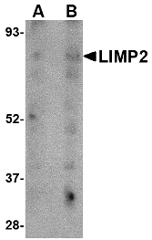 LIMPII / SCARB2 Antibody - Western blot of LIMP2 in human skeletal muscle tissue lysate with LIMP2 antibody at (A) 1 and (B) 2 ug/ml.
