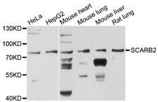 LIMPII / SCARB2 Antibody - Western blot analysis of extracts of various cell lines, using SCARB2 antibody at 1:3000 dilution. The secondary antibody used was an HRP Goat Anti-Rabbit IgG (H+L) at 1:10000 dilution. Lysates were loaded 25ug per lane and 3% nonfat dry milk in TBST was used for blocking. An ECL Kit was used for detection and the exposure time was 30s.