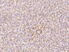 LIMPII / SCARB2 Antibody - Immunochemical staining of human SCARB2 in human liver with rabbit polyclonal antibody at 1:5000 dilution, formalin-fixed paraffin embedded sections.
