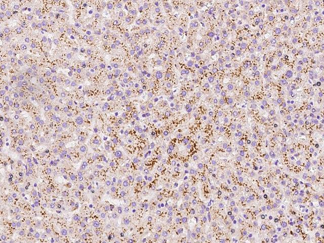 LIMPII / SCARB2 Antibody - Immunochemical staining of human SCARB2 in human liver with rabbit polyclonal antibody at 1:5000 dilution, formalin-fixed paraffin embedded sections.