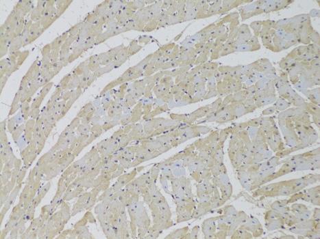 LIMPII / SCARB2 Antibody - Immunohistochemistry of paraffin-embedded Rat heart using SCARB2 Polyclonal Antibody at dilution of 1:100 (20x lens).